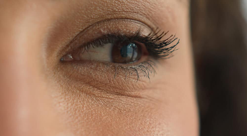 Blépharoplastie avant/après