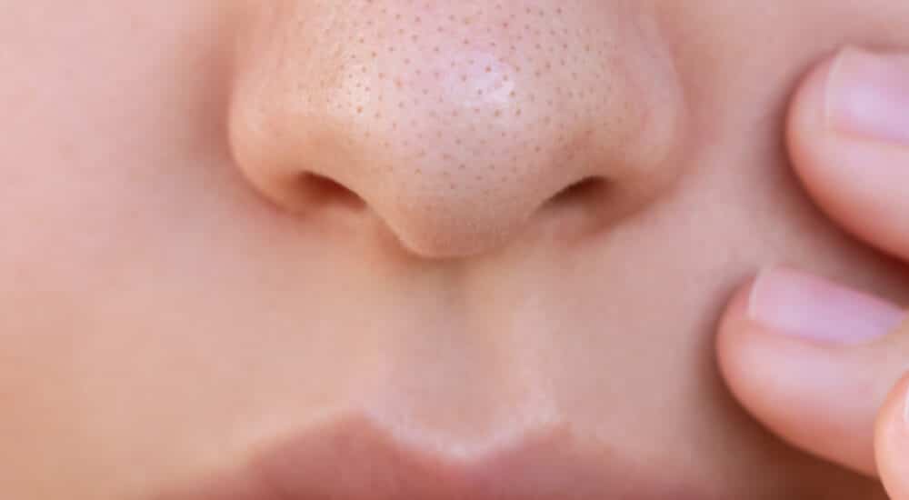 Rhinoplastie standardisée | Dr Raspaldo | Genève