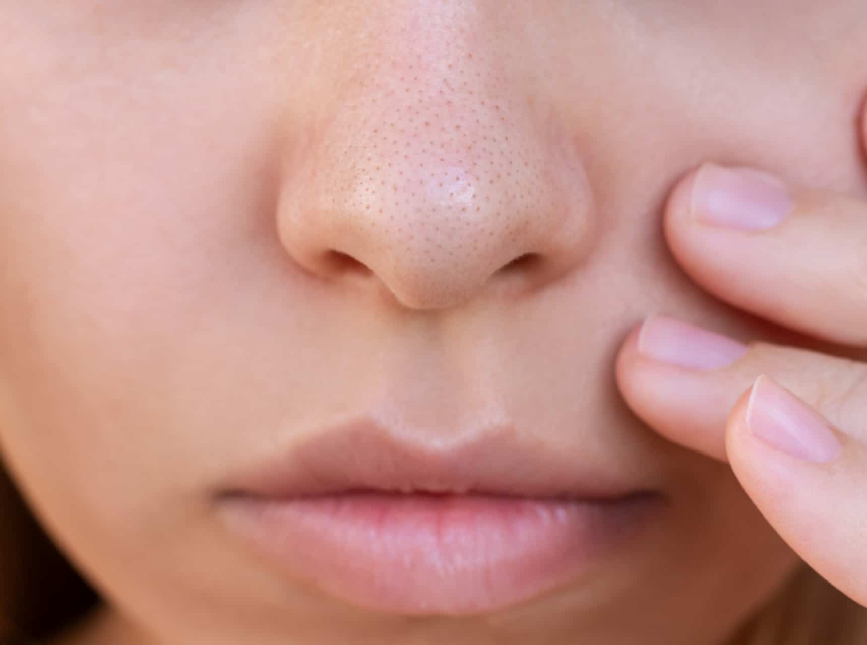 Rhinoplastie standardisée | Dr Raspaldo | Genève